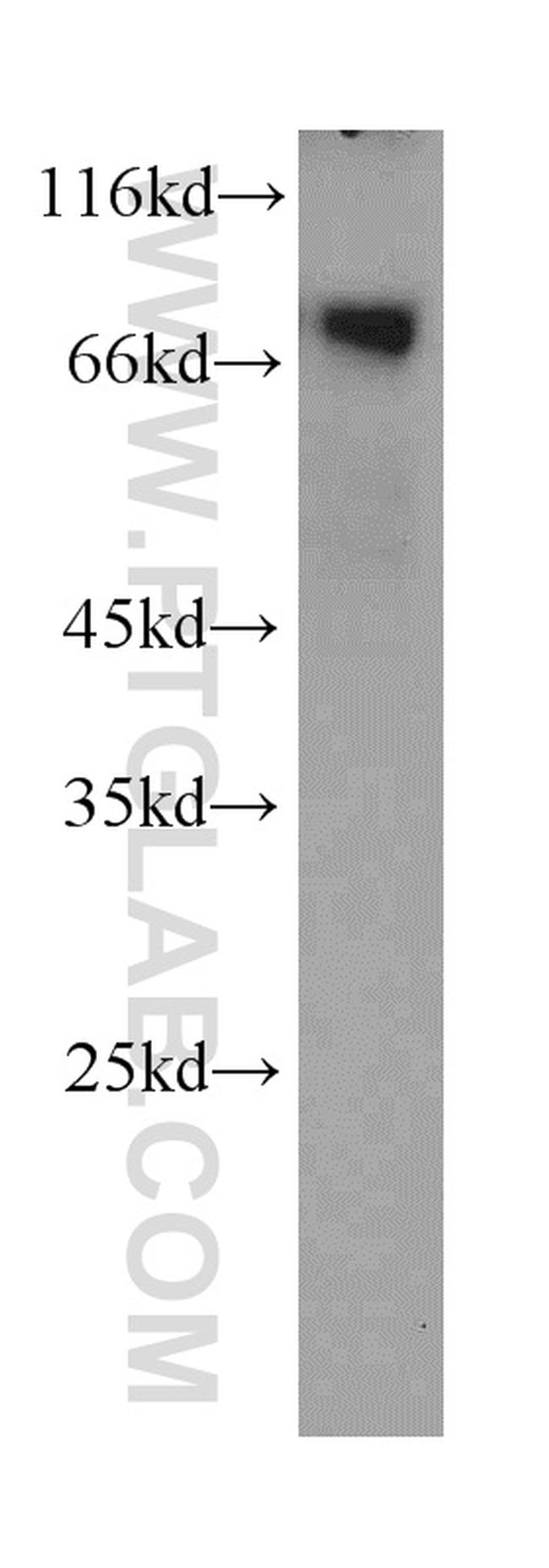 BAG3 Antibody in Western Blot (WB)