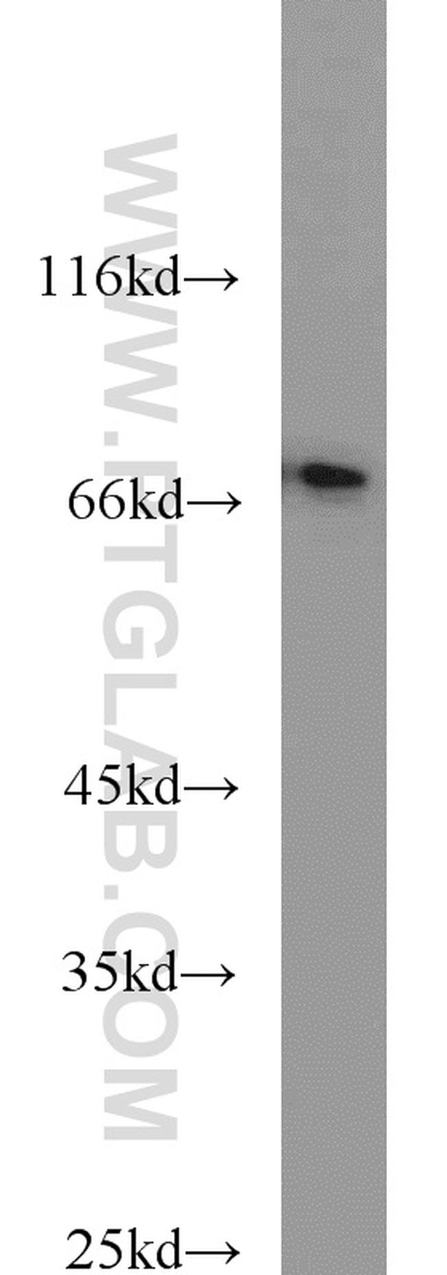 CD24 Antibody in Western Blot (WB)