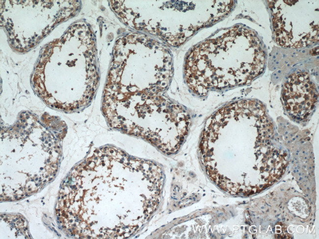 AGPAT1 Antibody in Immunohistochemistry (Paraffin) (IHC (P))