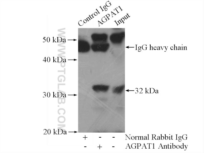 AGPAT1 Antibody in Immunoprecipitation (IP)