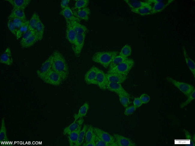 Plexin B2 Antibody in Immunocytochemistry (ICC/IF)