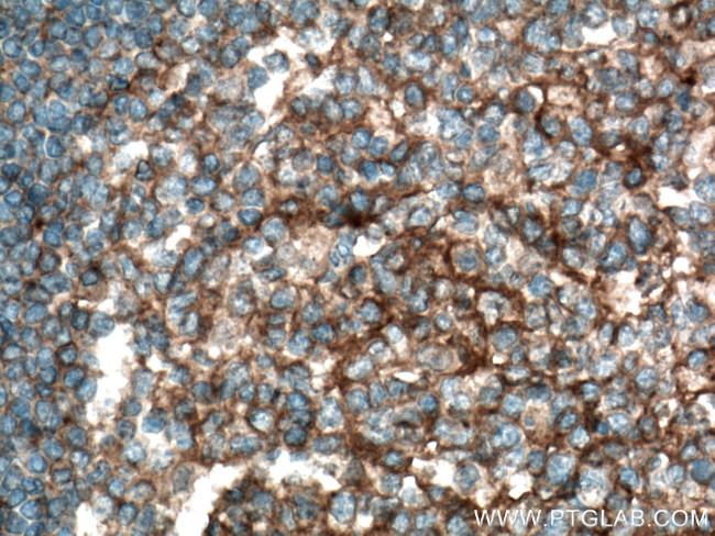 Plexin B2 Antibody in Immunohistochemistry (Paraffin) (IHC (P))