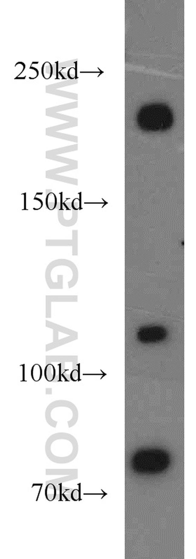 Plexin B2 Antibody in Western Blot (WB)