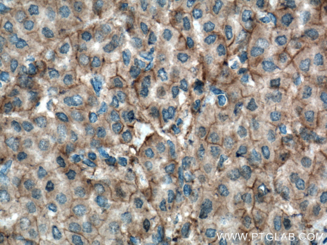 Plexin B2 Antibody in Immunohistochemistry (Paraffin) (IHC (P))