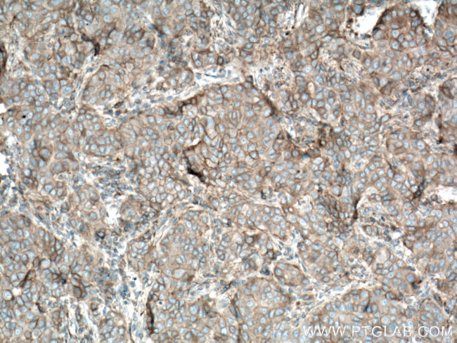 Plexin B2 Antibody in Immunohistochemistry (Paraffin) (IHC (P))