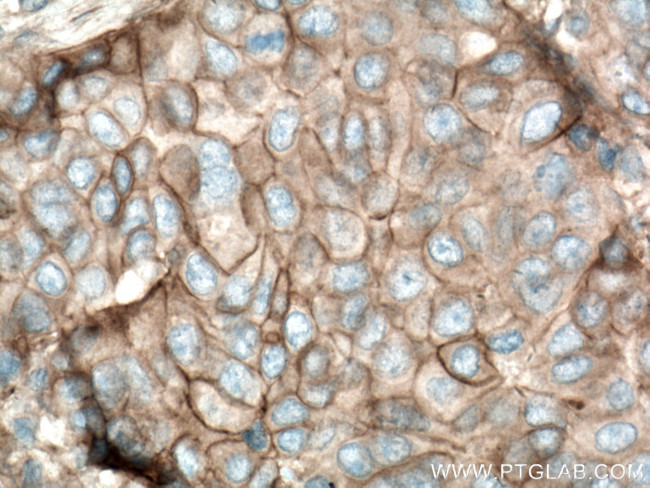 Plexin B2 Antibody in Immunohistochemistry (Paraffin) (IHC (P))