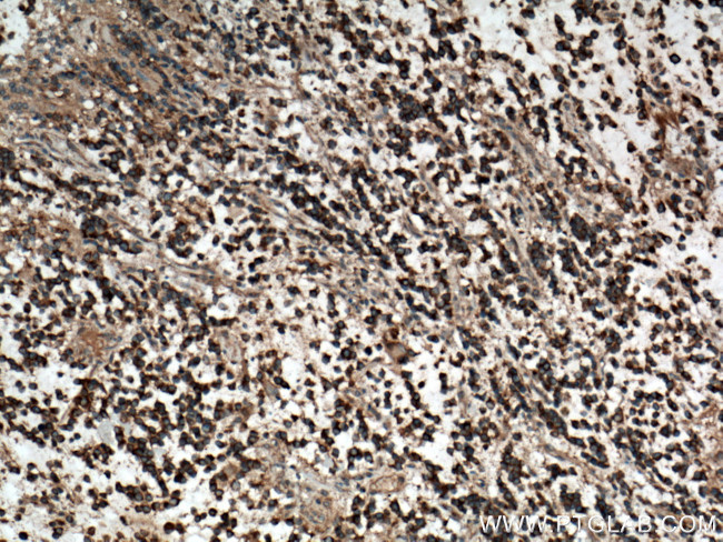 Plexin B2 Antibody in Immunohistochemistry (Paraffin) (IHC (P))