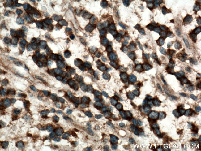 Plexin B2 Antibody in Immunohistochemistry (Paraffin) (IHC (P))