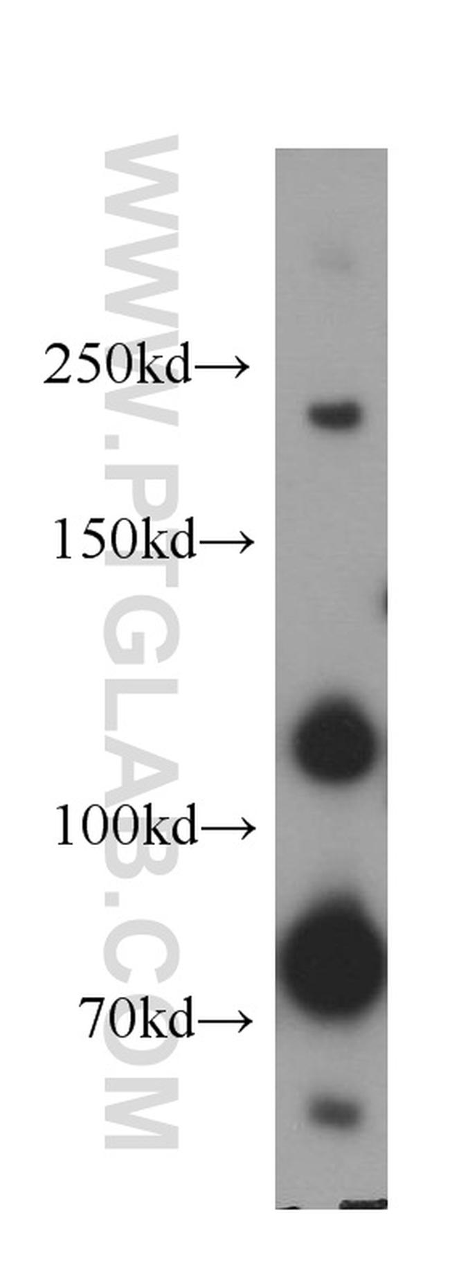 Plexin B2 Antibody in Western Blot (WB)