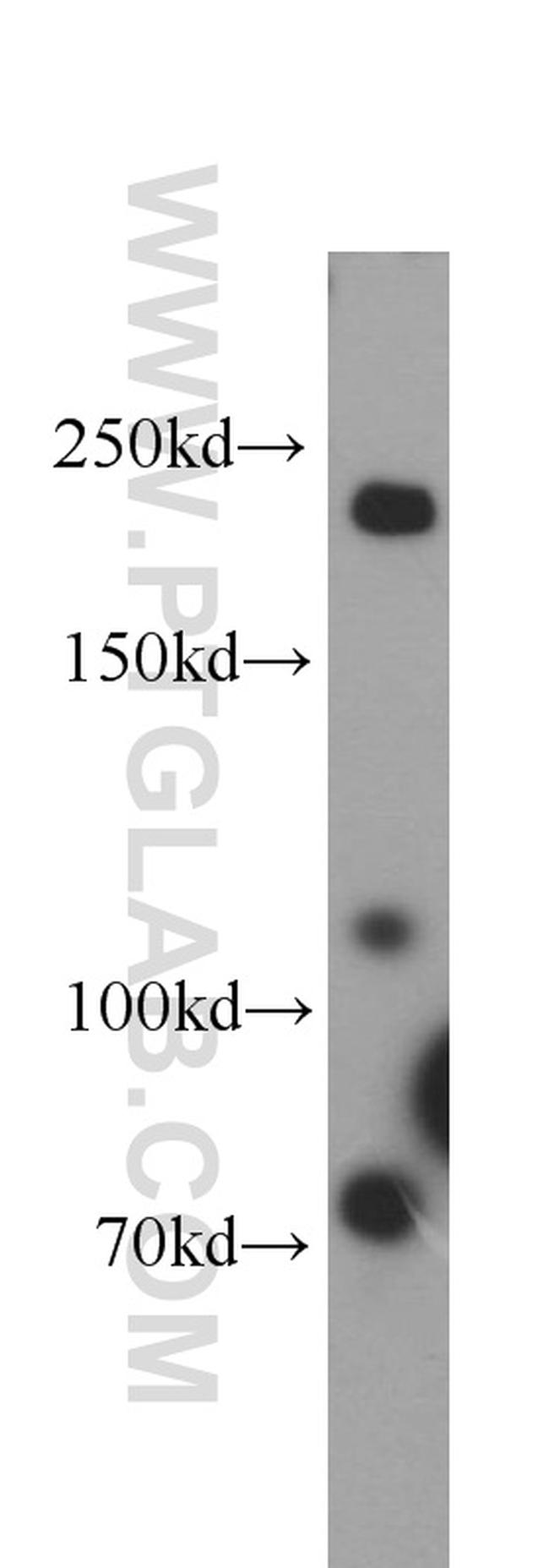 Plexin B2 Antibody in Western Blot (WB)