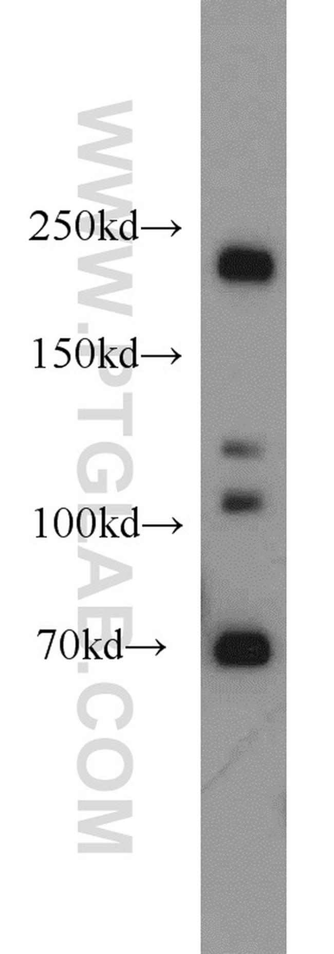 Plexin B2 Antibody in Western Blot (WB)