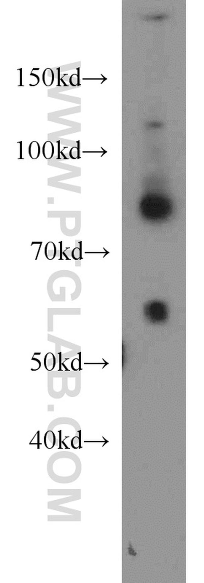 Plexin B2 Antibody in Western Blot (WB)