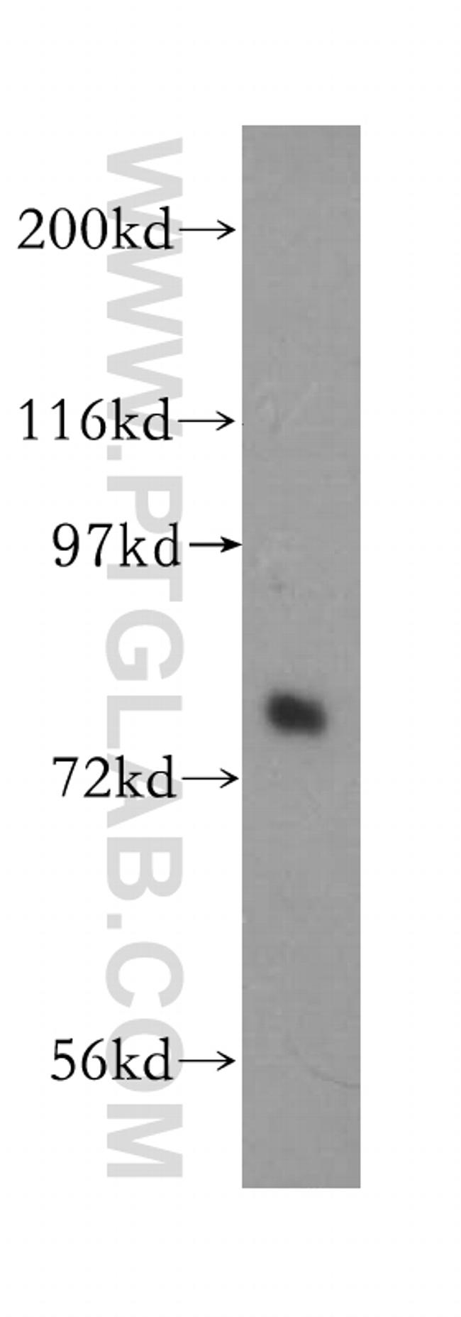 Plexin B2 Antibody in Western Blot (WB)