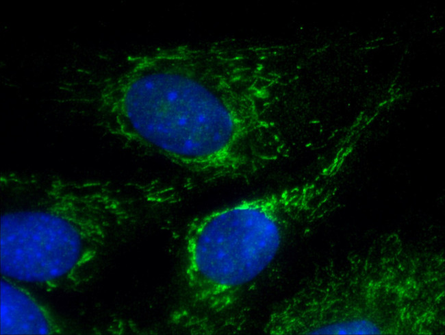 CHRNA1 Antibody in Immunocytochemistry (ICC/IF)