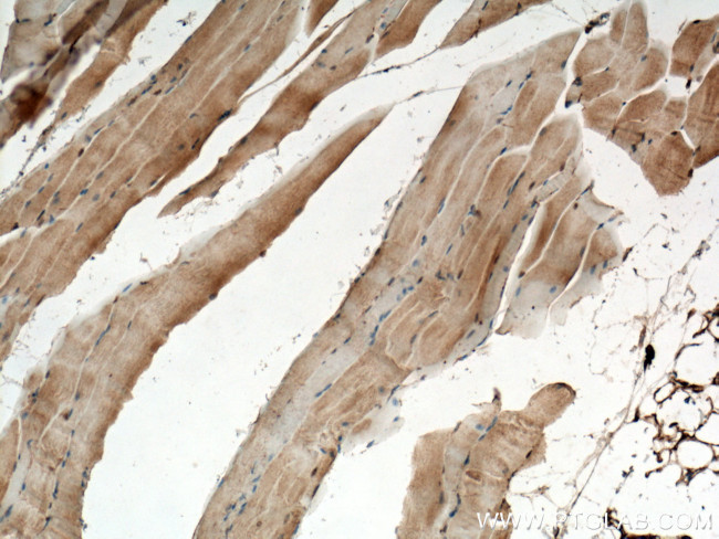 CHRNA1 Antibody in Immunohistochemistry (Paraffin) (IHC (P))