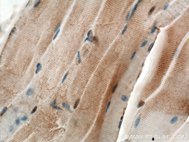 CHRNA1 Antibody in Immunohistochemistry (Paraffin) (IHC (P))