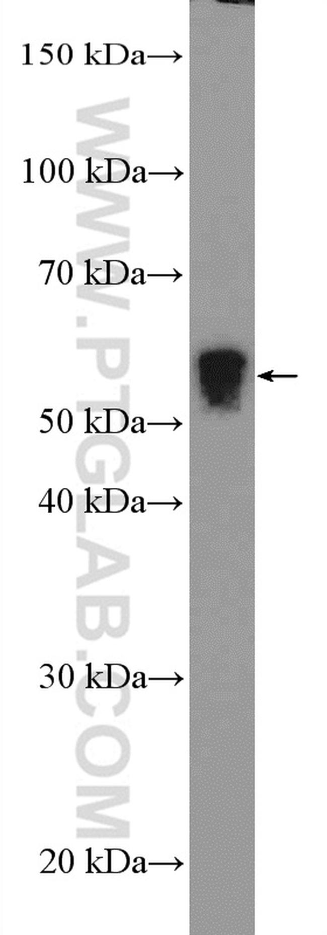 CHRNA1 Antibody in Western Blot (WB)