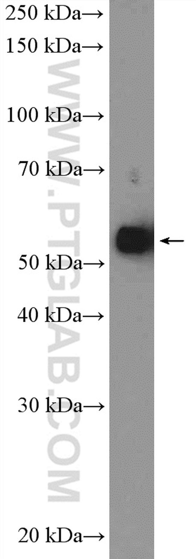 CHRNA1 Antibody in Western Blot (WB)