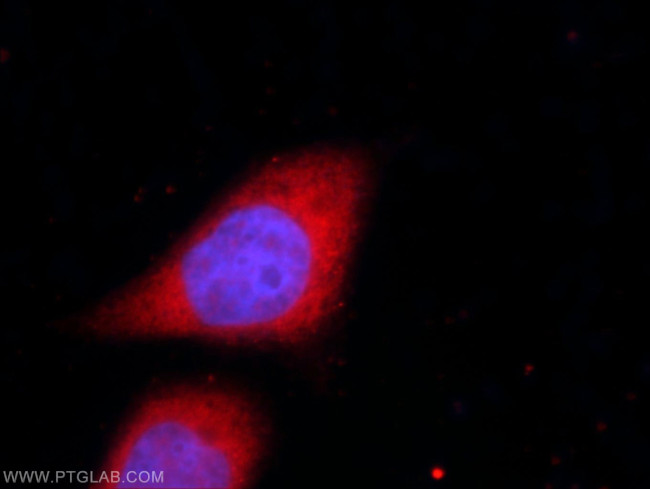 UFD1L Antibody in Immunocytochemistry (ICC/IF)