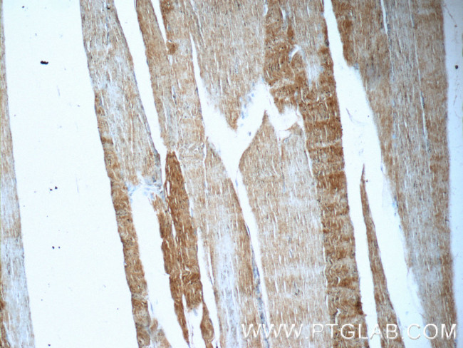 UFD1L Antibody in Immunohistochemistry (Paraffin) (IHC (P))