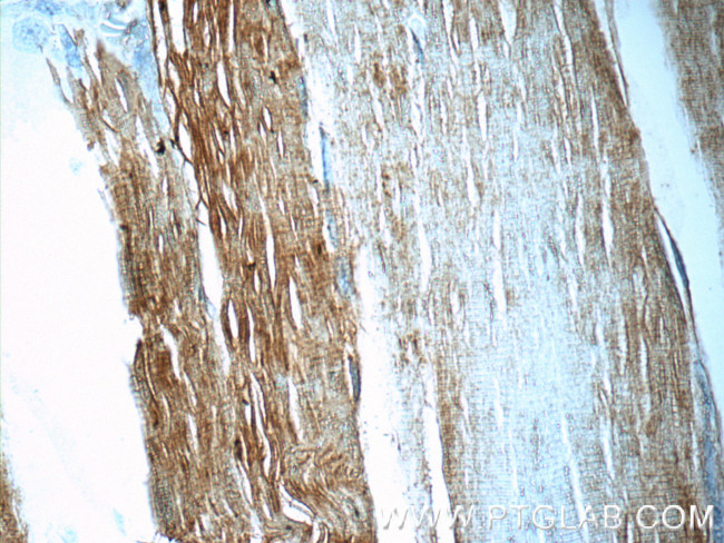 UFD1L Antibody in Immunohistochemistry (Paraffin) (IHC (P))