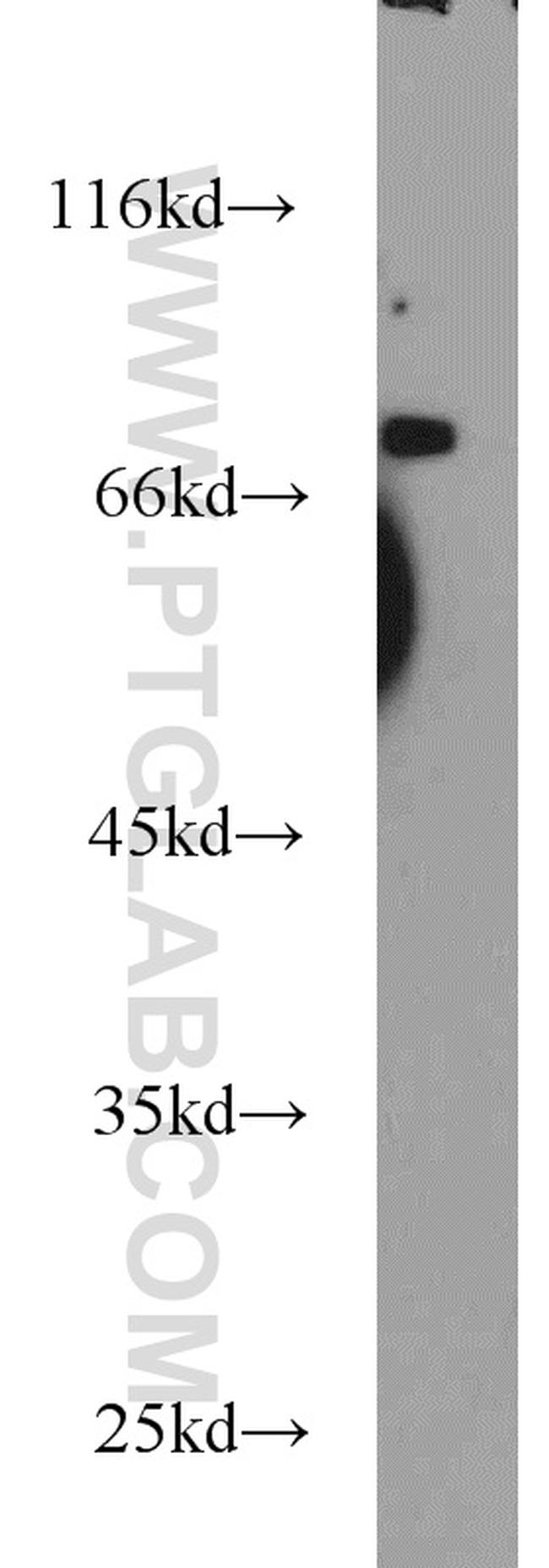 RORA Antibody in Western Blot (WB)