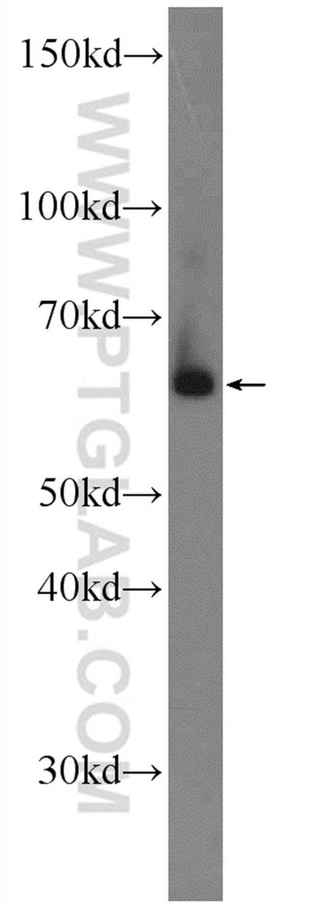 RORA Antibody in Western Blot (WB)