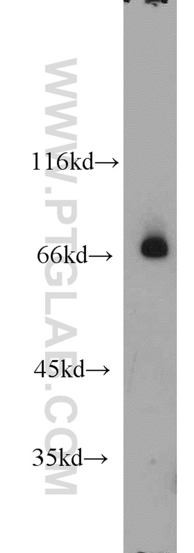 RORA Antibody in Western Blot (WB)