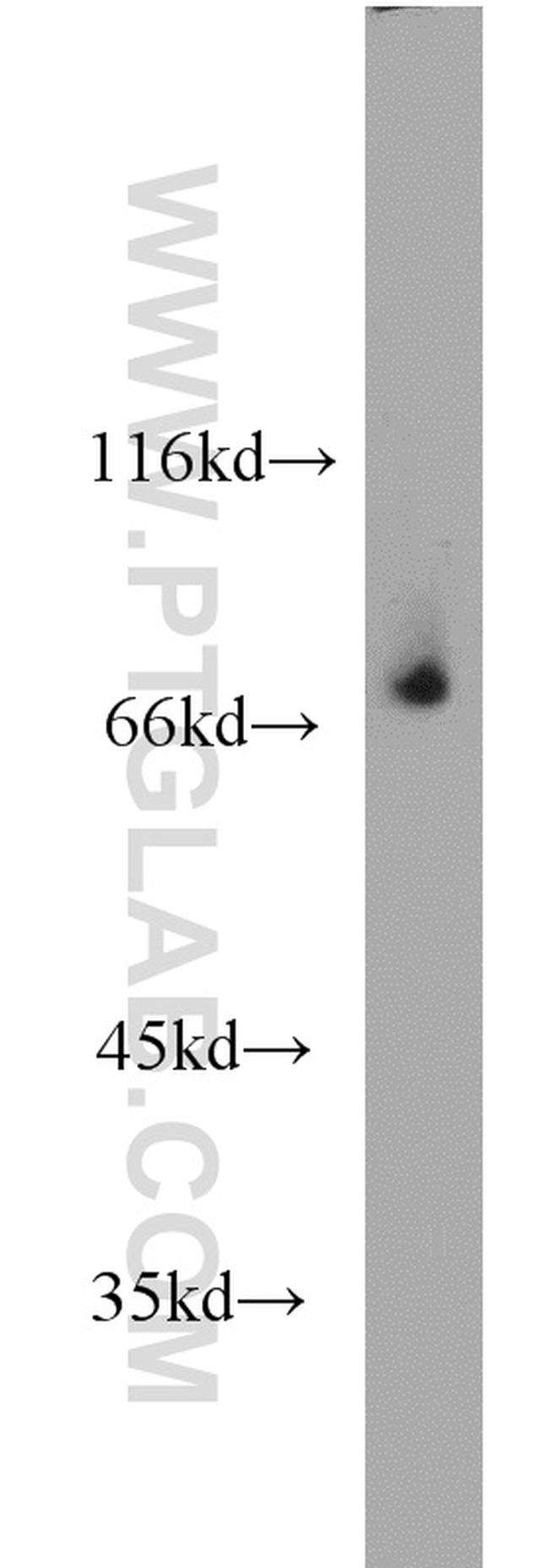 RORA Antibody in Western Blot (WB)