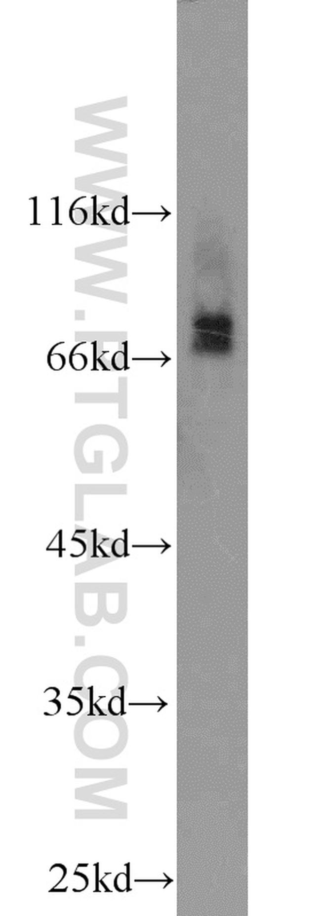 RORA Antibody in Western Blot (WB)