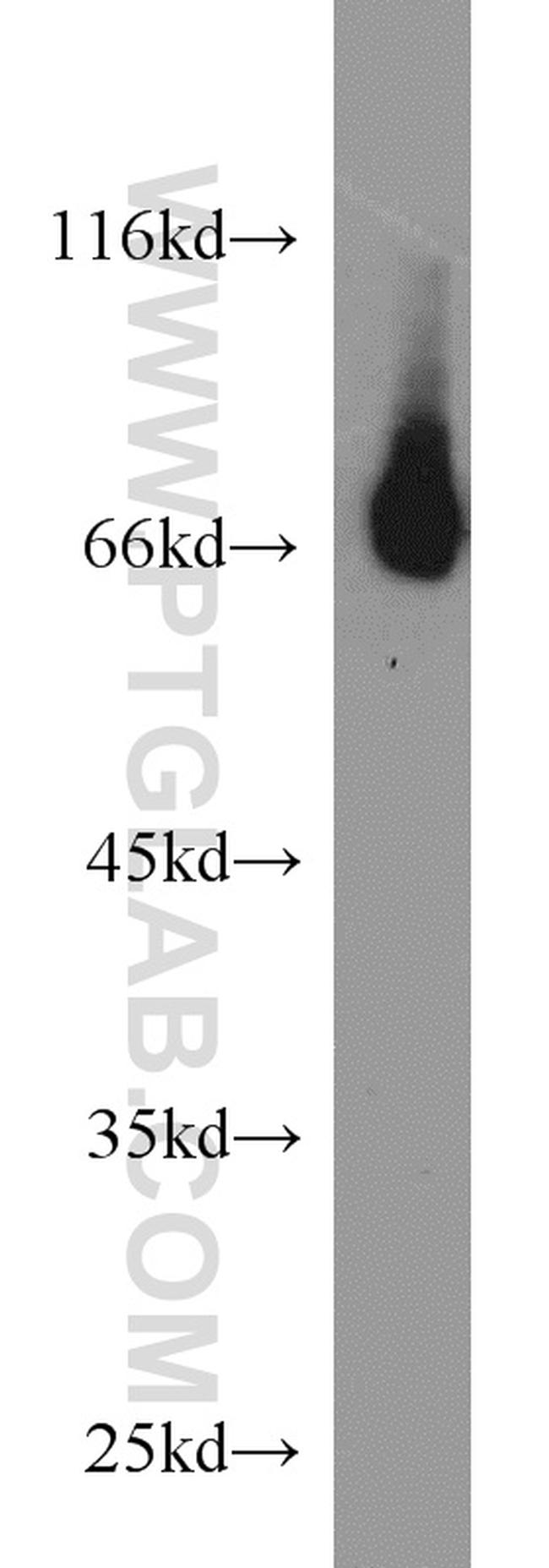 RORA Antibody in Western Blot (WB)