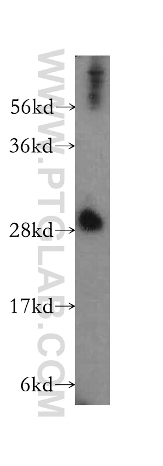 ING4 Antibody in Western Blot (WB)