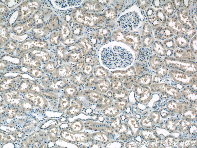 AP1M2 Antibody in Immunohistochemistry (Paraffin) (IHC (P))