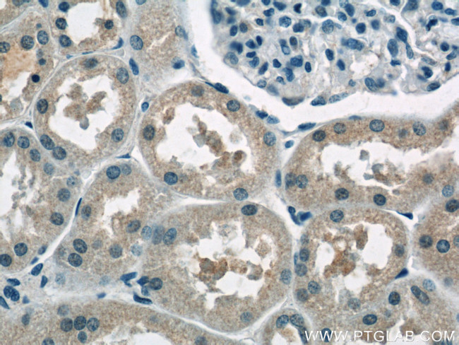 AP1M2 Antibody in Immunohistochemistry (Paraffin) (IHC (P))