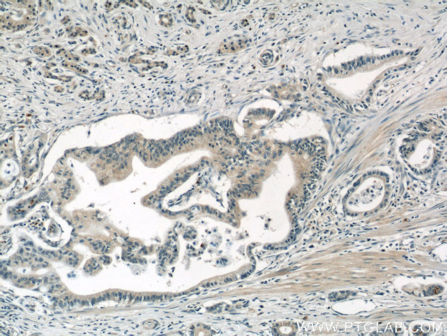 AP1M2 Antibody in Immunohistochemistry (Paraffin) (IHC (P))