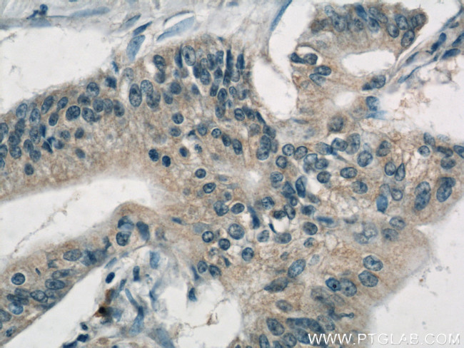 AP1M2 Antibody in Immunohistochemistry (Paraffin) (IHC (P))