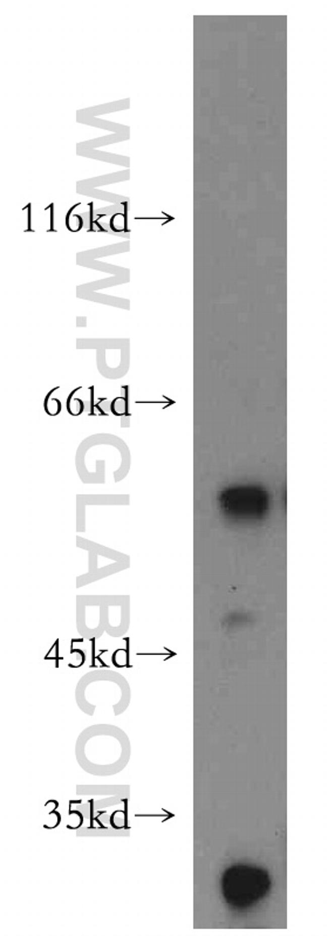 AP1M2 Antibody in Western Blot (WB)