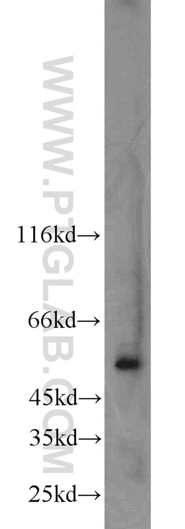 AP1M2 Antibody in Western Blot (WB)