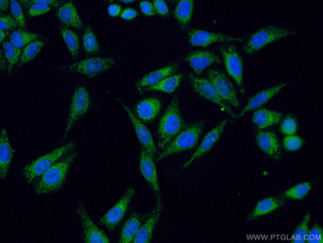 SDHB Antibody in Immunocytochemistry (ICC/IF)