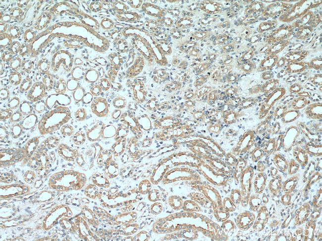 SDHB Antibody in Immunohistochemistry (Paraffin) (IHC (P))