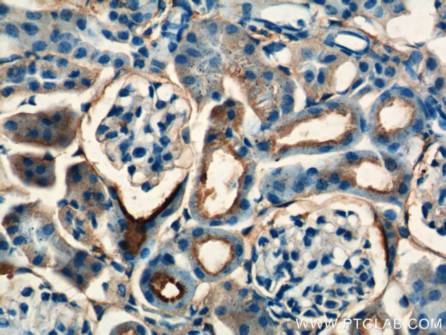 SDHB Antibody in Immunohistochemistry (Paraffin) (IHC (P))