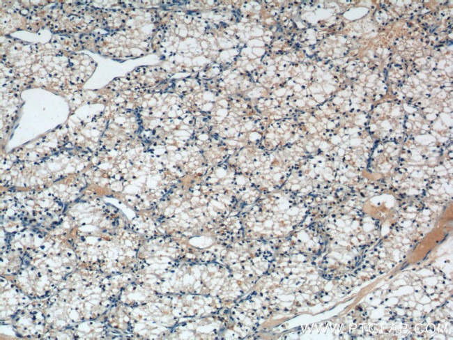 SDHB Antibody in Immunohistochemistry (Paraffin) (IHC (P))