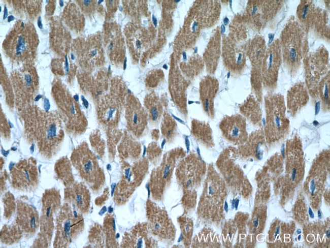 SDHB Antibody in Immunohistochemistry (Paraffin) (IHC (P))