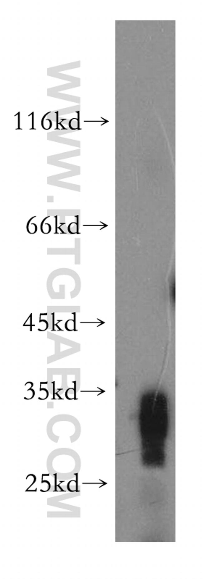 SDHB Antibody in Western Blot (WB)