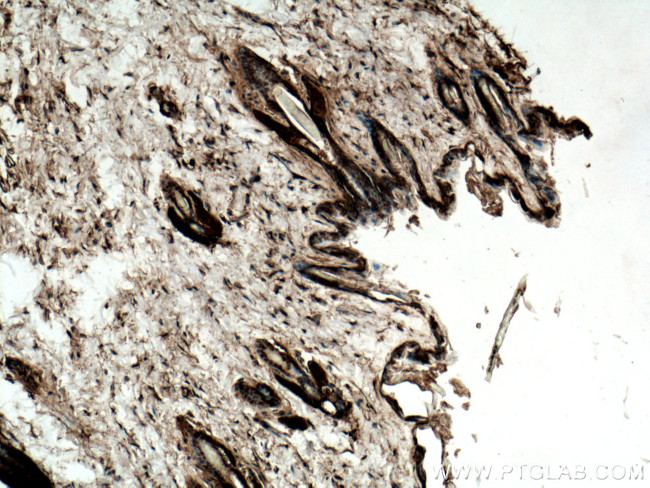 14-3-3 Sigma Antibody in Immunohistochemistry (Paraffin) (IHC (P))