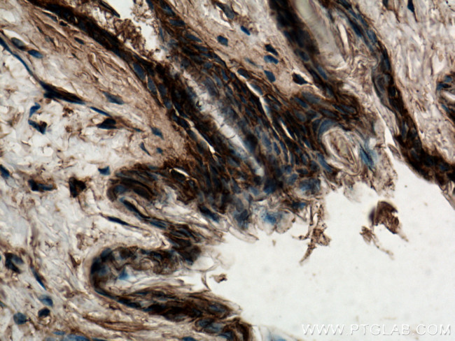 14-3-3 Sigma Antibody in Immunohistochemistry (Paraffin) (IHC (P))