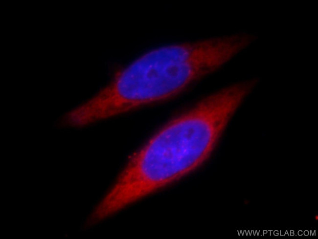 FASN Antibody in Immunocytochemistry (ICC/IF)