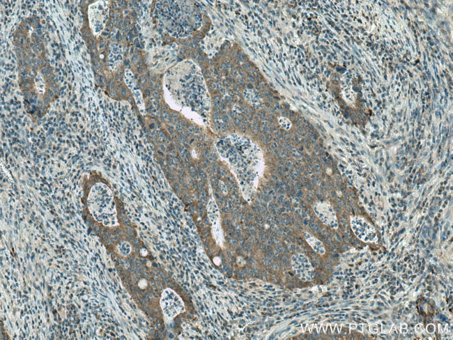 FASN Antibody in Immunohistochemistry (Paraffin) (IHC (P))