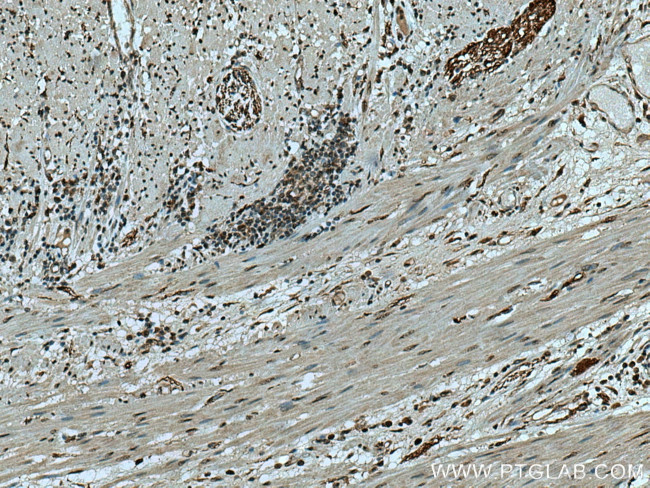 FASN Antibody in Immunohistochemistry (Paraffin) (IHC (P))