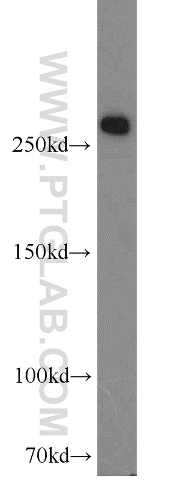 FASN Antibody in Western Blot (WB)